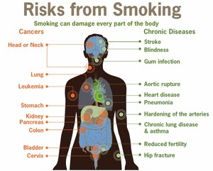 Optimal Wellbeing Hypnotherapy Pic 4 - Quit Smoking Easily