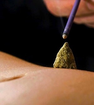 Zen Hands Pic 5 - Lighting a moxa cone on a belly to treat coldness in stomach