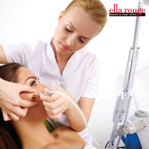 Ella Rouge Skin and Laser Clinics Pic 3 - ADVANCED SKIN TREATMENTS microdermabrasion micropen skinneedling skinpeels ellarougeskinandlaserclinic