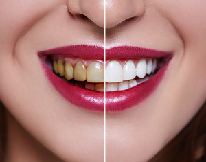 Springvale Dental Smiles Pic 4