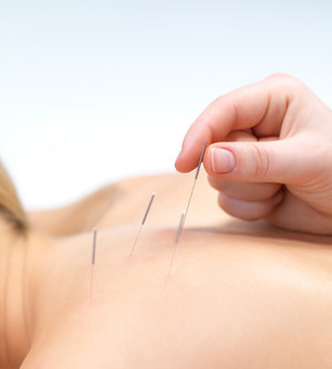 Health Moves Physiotherapy Pic 3 - Acupuncture for pain relief