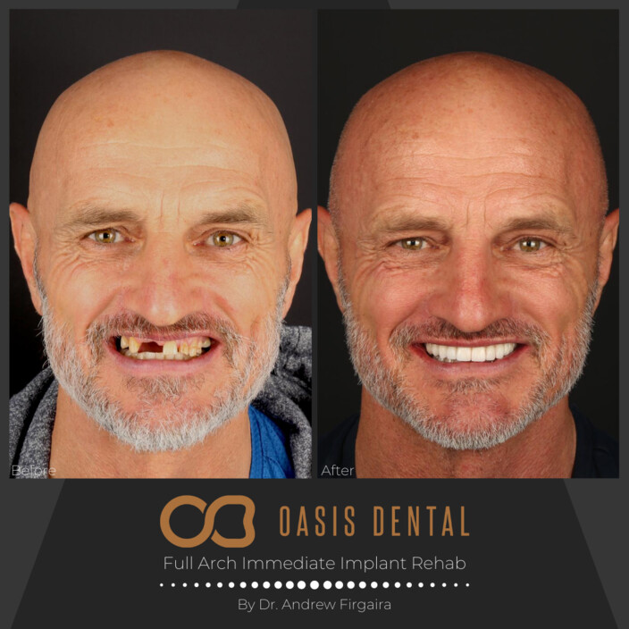 Oasis Dental Studio - Palm Beach Pic 1