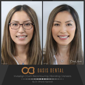 Oasis Dental Studio - Palm Beach Pic 3