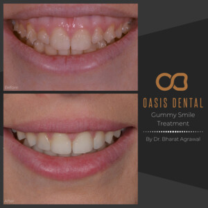 Oasis Dental Studio - Palm Beach Pic 4