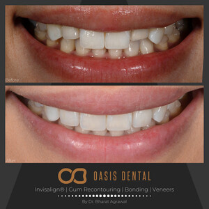 Oasis Dental Studio - Palm Beach Pic 5