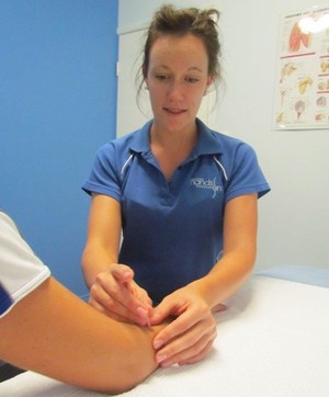 Gladstone Hands On Physiotherapy Pic 5 - Dry Needling