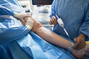 The Vein Institute Pic 4 - Medical super glue treatment for varicose veins