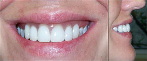 Active Denture Clinic Pic 2