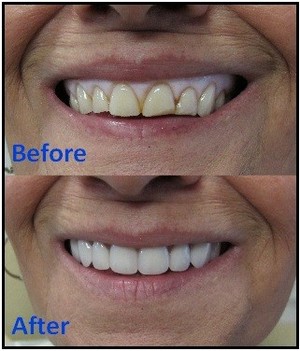 Active Denture Clinic Pic 3