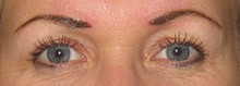 For Goodness Sake Micro Pigmentation Clinic Pic 2 - Eye Brows before they lighten