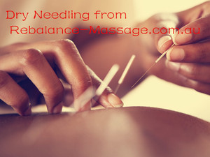 Rebalance Bodywork Mackay Pic 2 - dry needling from rebalance massage mackay