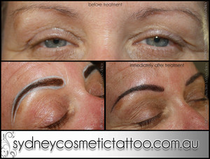 Sydney Cosmetic and Corrective Tattoo Clinic Pic 3 - Beautiful Brows