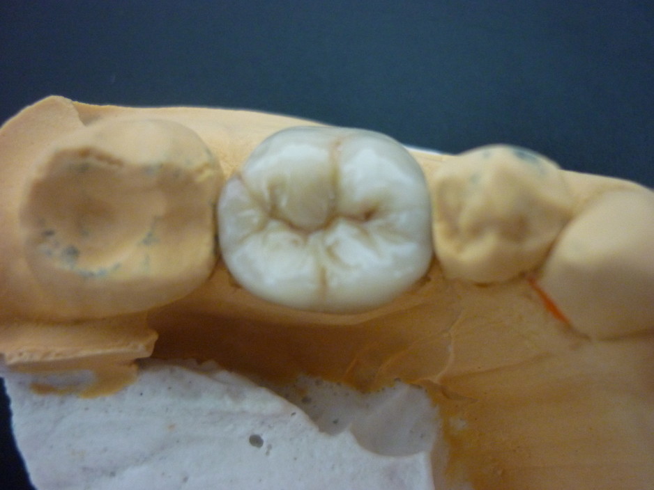 M A Dental Ceramics Pic 1