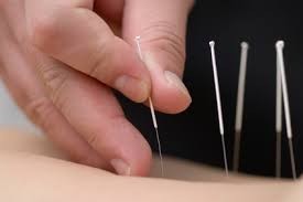 YIN YANG Acupuncture Health Centre Pic 2 - Acupuncture