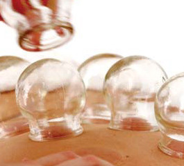 Discover Chinese Medicine Pic 1 - cupping is one of the treatments we use at our clinic