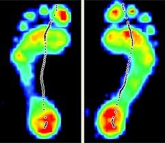 Trevor Lane Podiatry Pty Ltd Pic 1 - Gait scan helps us see exactly where your foot problem is