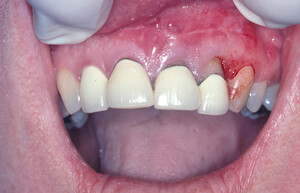 Illawarra Oral And Maxillofacial Surgery Pic 2