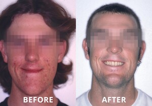 Illawarra Oral And Maxillofacial Surgery Pic 3