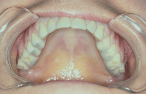 Illawarra Oral And Maxillofacial Surgery Pic 4