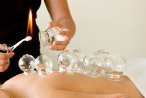 Active Alternatives Pic 3 - Flame Cupping