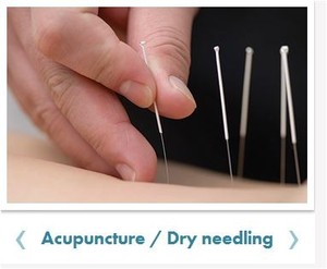 Life Ready Physio Pic 5 - Acupuncture Dry needling