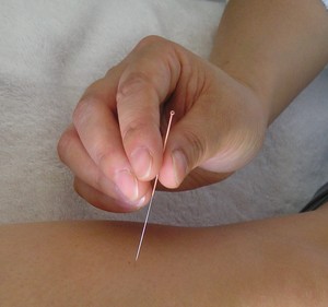 Jade Buddha Chinese Herbs Pic 3 - Chinese Acupuncture Treatment