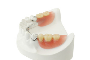 Total Denture Care Pic 5