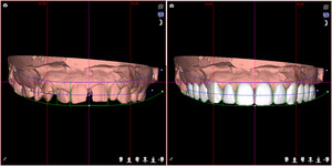 Burwood Dental Care Pic 3