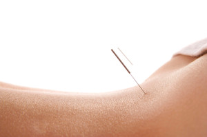 Bayside Health Professionals Pic 2 - acupuncture redlands