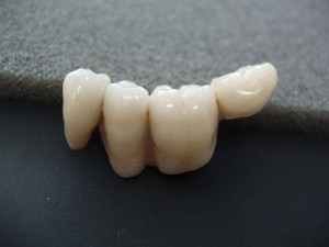 C.K. Denture Clinic Pic 3 - Crown Bridge Work supplied to Dentists only