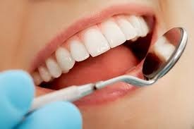 Annerley Dental Pic 4 - Cosmetic dentistry services include white fillings crowns bridgework bleaching