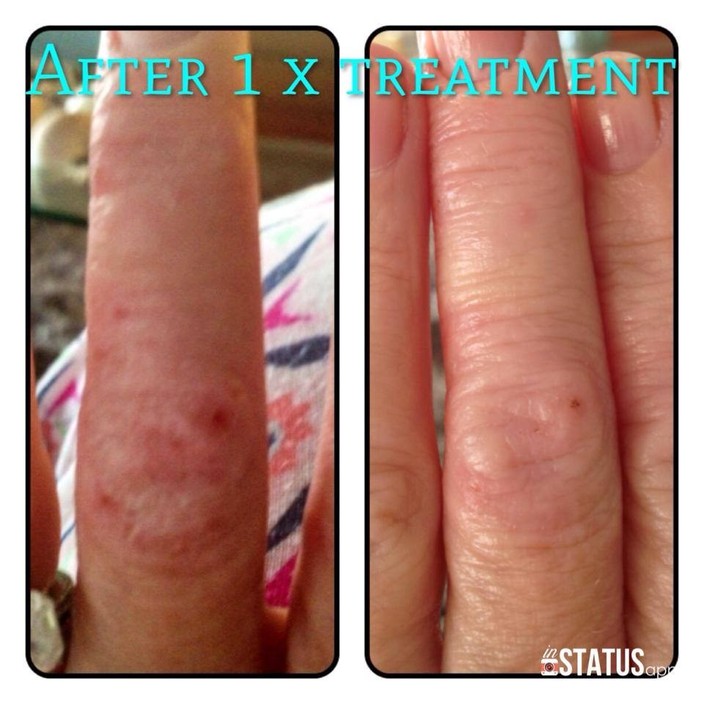 Karmic Beauty Pic 1 - Dermatitis Treatment