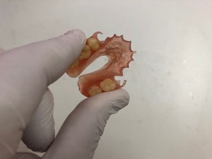 ( Paul & Robert Werner ) Denture Clinics Pic 5 - Flexible Dentures no metal hooks