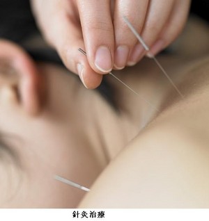 Silver Needle Acupuncture Clinic Pic 5