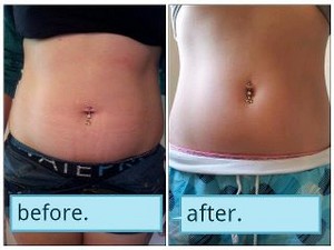 Tighten, Tone and Firm in as Little as 45minutes!!! Pic 3 - One of my clients who had such fantastic results after her first wrap that she signed up and now has her own business