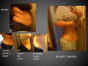 Tighten, Tone and Firm in as Little as 45minutes!!! Pic 2 - How amazing are these results needless to say this lady is over the moon with her results after using the ultimate body applicators over just 7 weeks