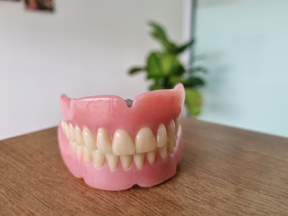 The Dental Corner Pic 1 - Full acrylic dentures