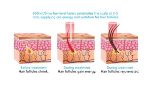 Innovative Hair Loss Solutions Pic 5 - have you ever thought that you could have more hair There may be no cure but we can treat your hair loss and get you looking younger and feeling more confident