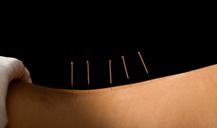 Elements of Life Clinic Pic 1 - Acupuncture