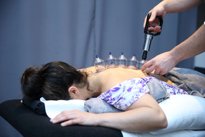 Kinesis Physiotherapy & Wellness Clinic Pic 3 - Cupping Therapy