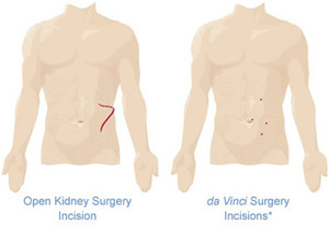 Katelaris Urology Hornsby Pic 5