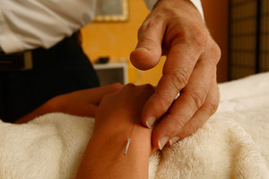 Paul McLeod Moxa Massage & Acupuncture Pic 3 - Needles are sterile and only used once