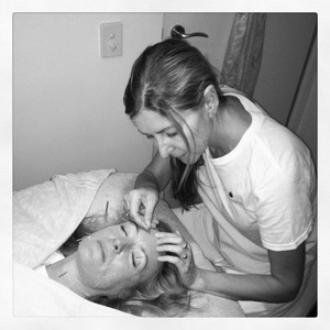 Sage Beauty Pic 5 - Diane giving Facial Rejuvenation Acupuncture at Sage Beauty