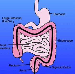 Westpoint Endoscopy Day Hospital Pic 3 - Colonoscopy