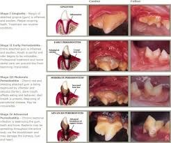 Pet Teeth Cleaning Pic 4