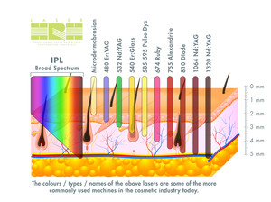 Laser HRH Pic 5 - Laser vs IPL Depth penetration comparison chart