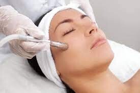 Lisah Cosmetic Tattoo Pic 3 - Microdermabrasion helps removes the outer layer of the skin leaving your skin soft and radiant