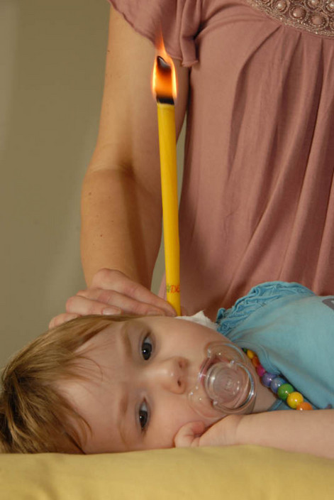 Ear Candling North Lakes Pic 1