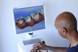 Station Square Dental Pic 5 - CEREC Dr Ronak Patel Station Square Dental Centre