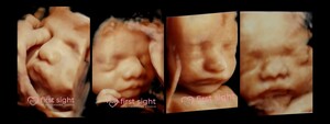 First Sight 4d Ultrasound Studio Pic 2